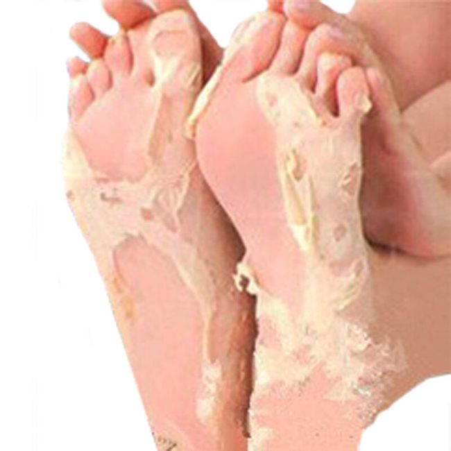 Zdravilne nogavice za odmrlo kožo 1