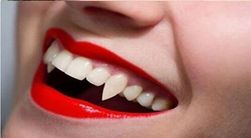 Dinți de vampir - 4 variante