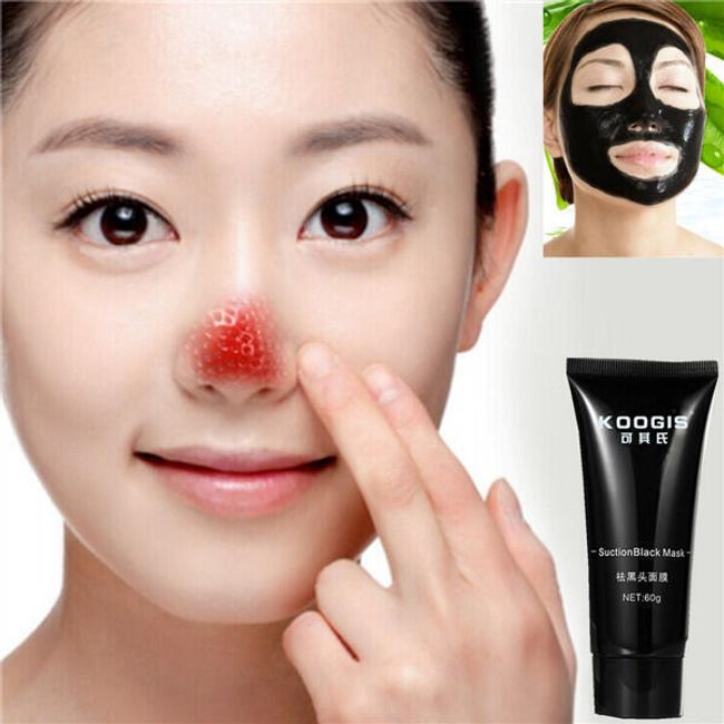 Mitesszer Eltavolito Maszk Black Mask Shipgratis Hu
